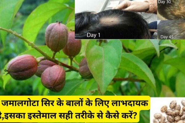 क्या जमालगोटा सिर के बालों के लिए लाभदायक है,इसका इस्तेमाल सही तरीके से कैसे करें?